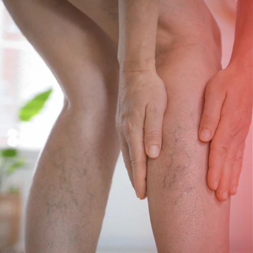 Terapia światłem czerwonym na żylaki - urządzenie Lumaflex w działaniu